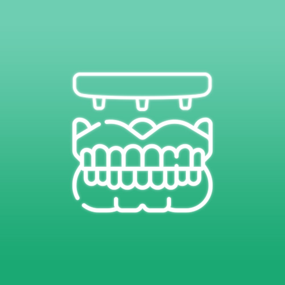 A prótese protocolo é o que existe de mais moderno para a reabilitação de um paciente que perdeu todos os dentes. Ela é fixada com implante ósseo integrados e sobre eles parafusada uma prótese total, tipo dentadura.