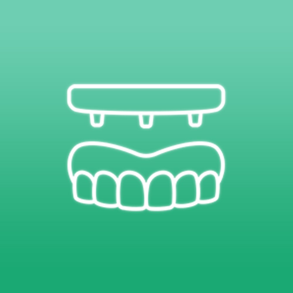 O principal benefício da carga imediata é ter dentes no mesmo dia com rapidez, já que o procedimento é realizado em uma única consulta, reduzindo o tratamento em um curto prazo.
